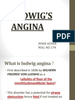 Ludwig'S Angina: Ayma Azhar Roll No 174