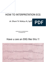 Presentasi Ws Ekg Sakinah