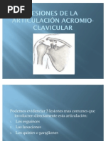 Lesión Acromio Clavicular