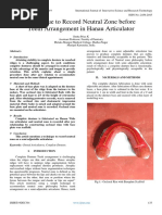 Technique To Record Neutral Zone Before Teeth Arrangement in Hanau Articulator