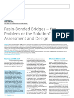 Dent Update 2016 Resin-Bonded-Bridge-Design