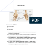 Fractura de Codo