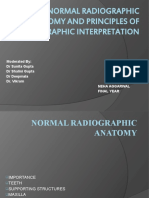 Normal Radiographic Anatomy and Principles of Radiographic Interpretation