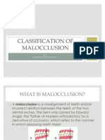 Classification of Malloclusion1