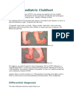 Paediatric Clubfoot: Differential Diagnosis