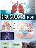 NEUMOCONIOSIS