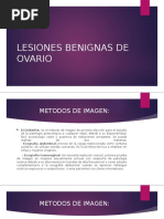 Lesiones Benignas de Ovario