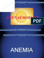 Pernicious Anemia