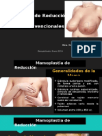 Mamoplastia de Reducción. Técnicas Convencionales