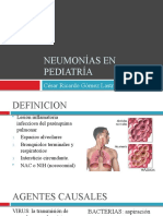 Neumonías en Pediatría CESAR