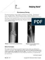 Percutaneous Pinning: Pictures 1 and 2