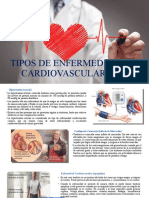 Tipos de Enfermedades Cardiovasculares