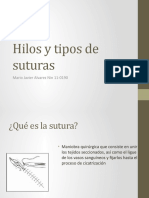 Hilos y Tipos de Suturas