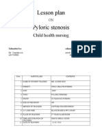 2.lesson plan-PYLORIC STENOSIS - JS