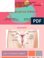 Embarazo Ectopico