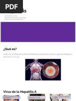 Hepatitis ABCD