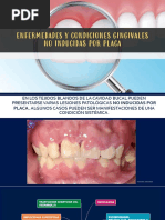 Enfermedades Gingivales No Inducidas Por Placa