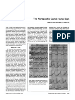 Nonspecific Camel-Hump: Specific