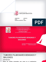 75 Tumores Pulmonares Benignos y Malignos PDF