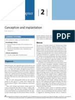 Concepcion e Implantacion