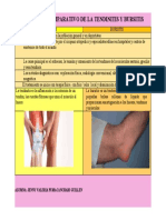 Cuadro Comparativo de Tendinitis y Bursitis