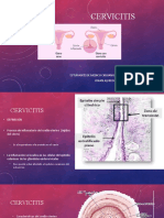 Cervicitis Ginecologia Practica