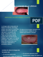 Neoplasias y Cancer de La Lengua.