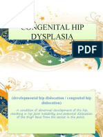 Congenital Hip Dysplasia