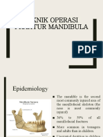 Teknik Operasi Fraktur Mandibula