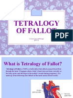 Tetralogy of Fallot: Arianna Jasminemabunga Bsn-2B