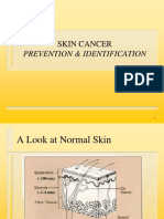 Prevention & Identification: Skin Cancer