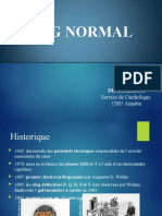 ECG Normal