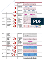 Rhythm Description Schematic Diagram Egc Characteristics Sample Trace