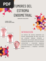 Tumores Del Estroma Endometrial