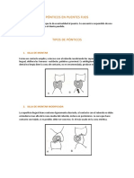 Requisitos Del Póntico