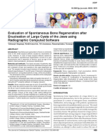 Evaluation of Spontaneous Bone Regeneration After Enucleation of Large Cysts of The Jaws Using Radiographic Computed Software.2016