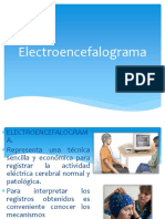 Electroencefalograma - FAA