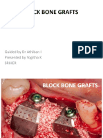 Block Bone Grafts: Guided by DR Athiban I Presented by Yogitha K Sriher