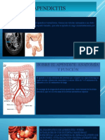 Apendicitis