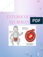 14 Enterocolitis Necrotizante