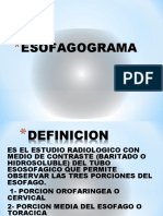 ESOFAGOGRAMA