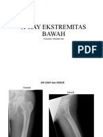 X-Ray Ekstremitas Bawah