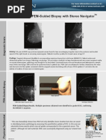 Case Study:: PEM-Guided Biopsy With Stereo Navigator