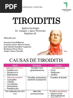 PDF Tiroiditis