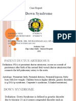 PDA in Down Syndrome: Case Report