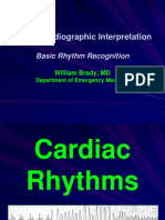 Introduction To ECG Rhythms