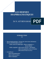 Hernies Diaphragmatiques