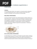 Apertura en Molares Superiores e Inferiores