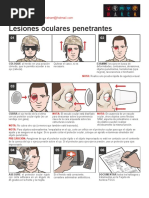 Lesiones Oculares