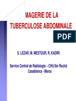 RX de La TBC Abdominale 2